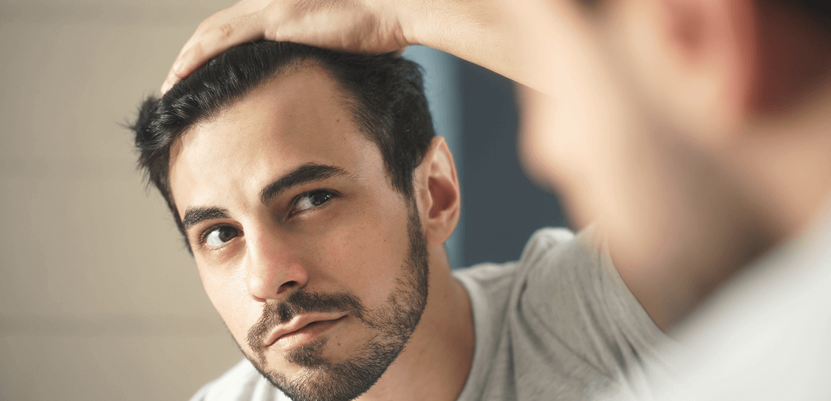 LA CHUTE DE CHEVEUX